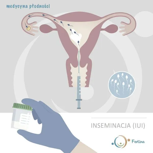 Inseminacja i etyka