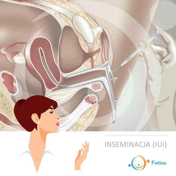 Kościół katolicki o inseminacji